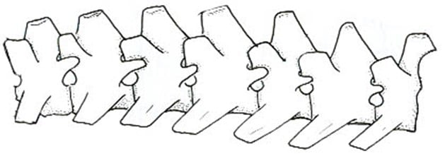 Figure 12. The Lumbar Vertebrae
