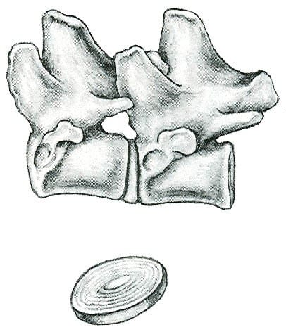 Figure 9. Side View of Vertebrae Showing Intervertebral Disc